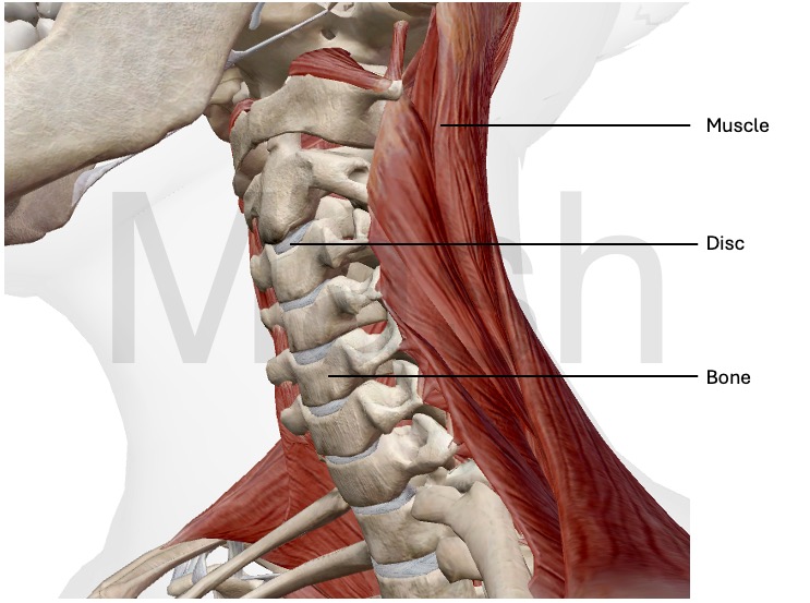 Figure for Neck Pain