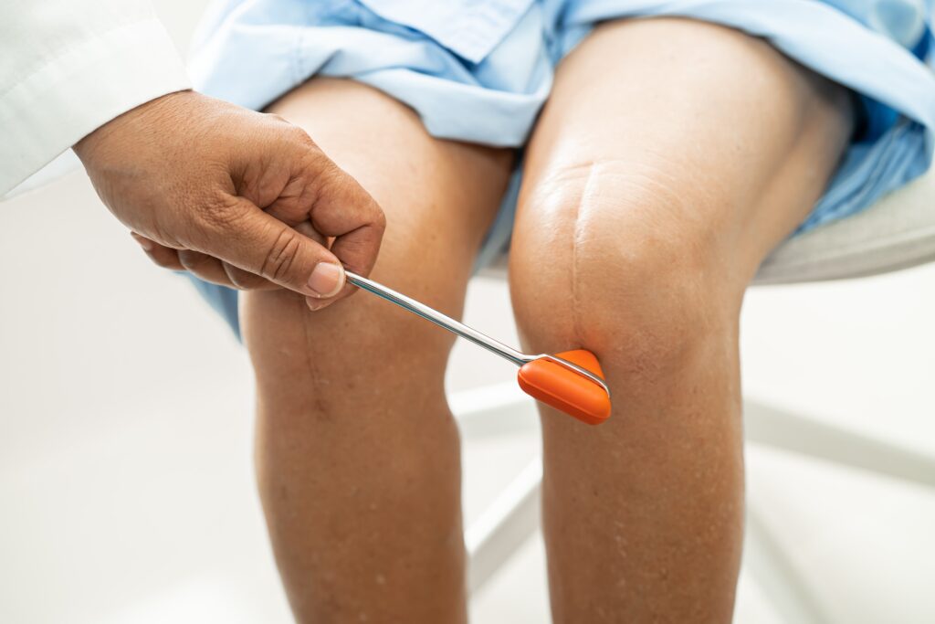 knee-condition5 – Mash Spine & Orthopaedics