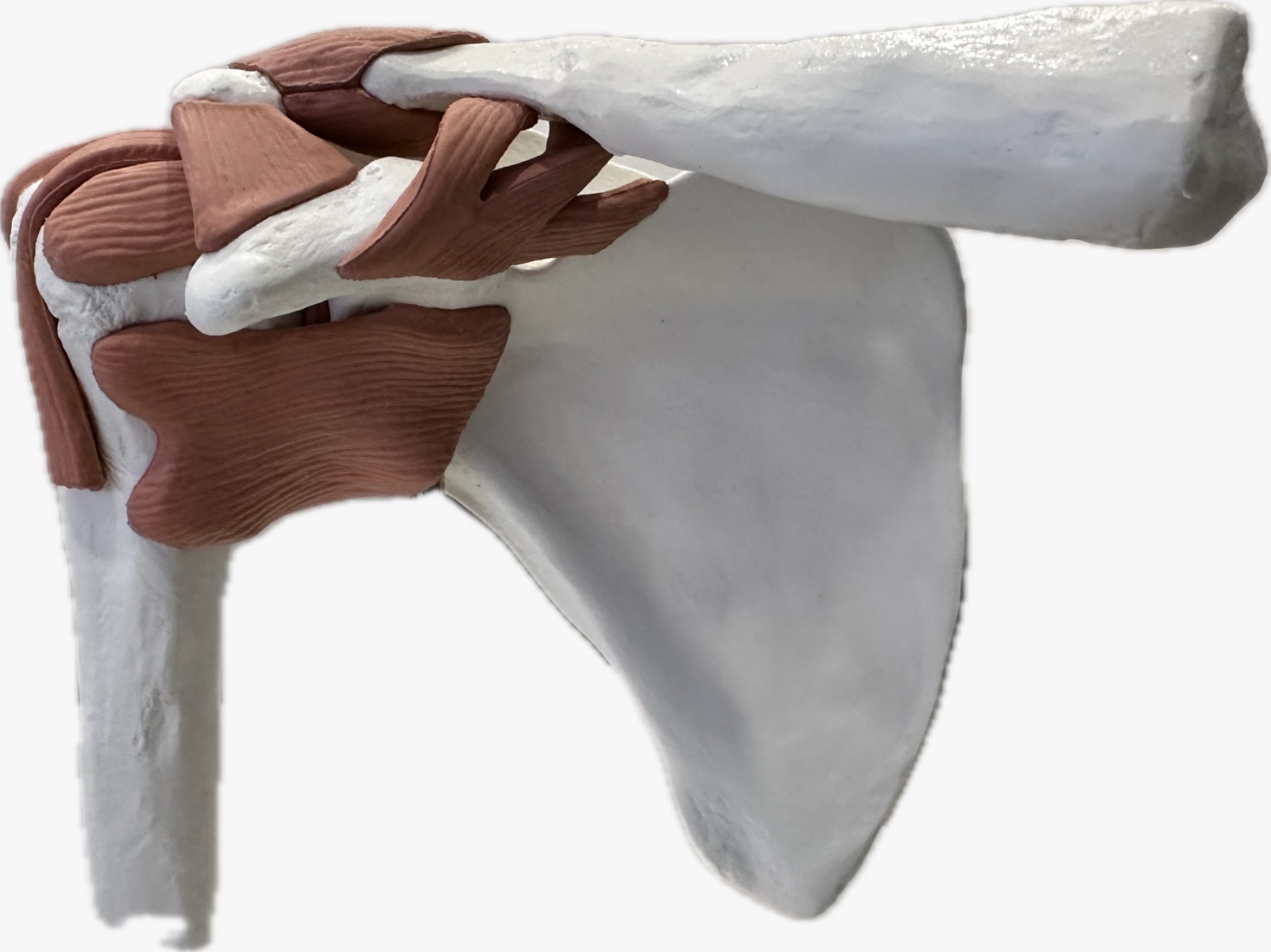 Picture showing shoulder joint with some muscles which can get injured causing shoulder pain
