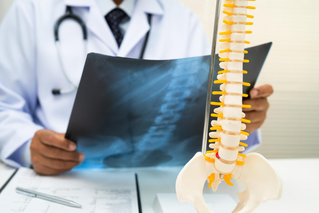 Doctor in white coat reviews a spine X-ray while a vertebral model sits on the desk.